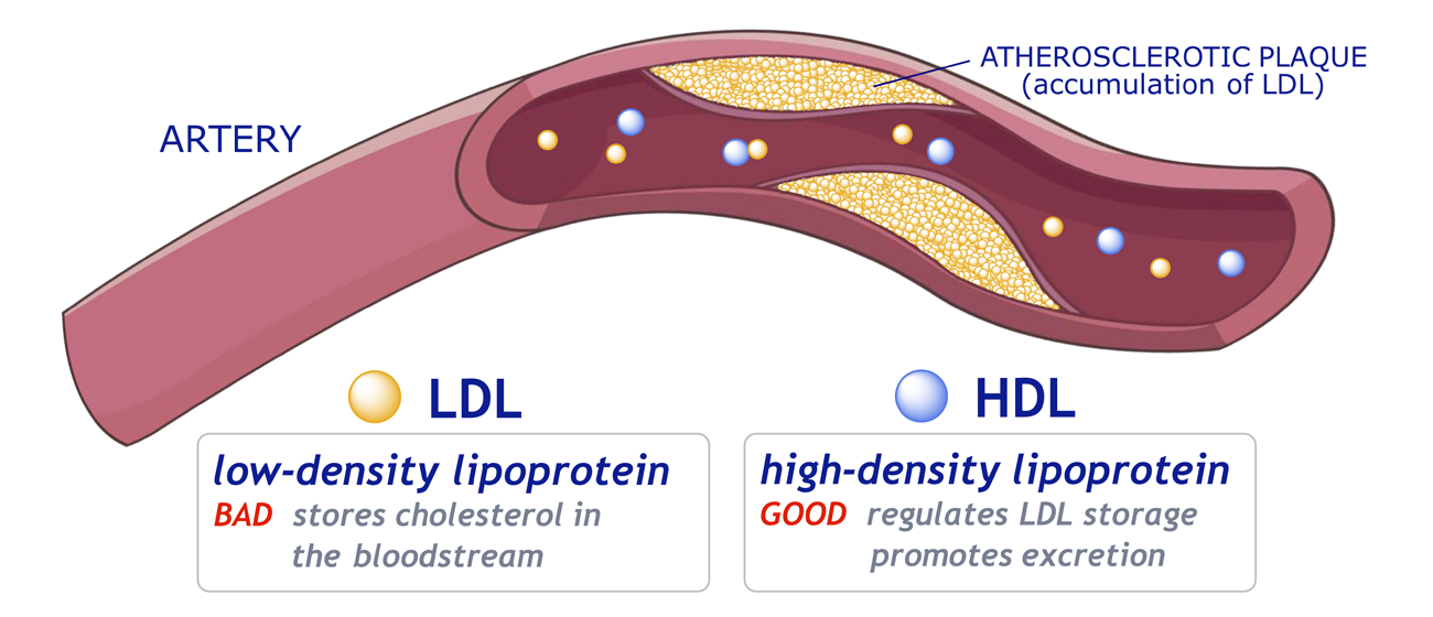 Graphic showing role of lipoproteins (LDL and HDL) in cholesterol transport